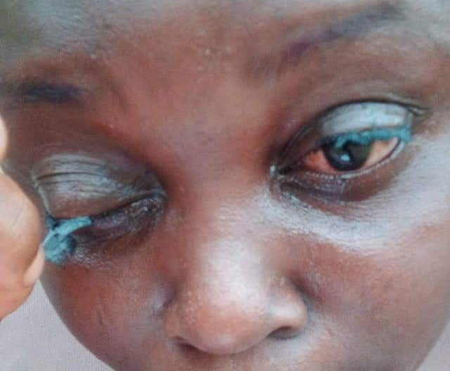 WATCH: Nigerian Lady In Tears After Almost Losing Her Sight, Vows Not To Fix Eye Lashes Again -