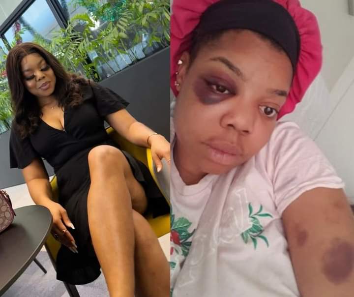 I'm Tired, Woman Calls Nigerian Baby Daddy Out Over Domestic Violence, Photos