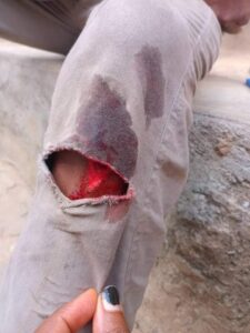 Masquerade Brutalises NYSC Member